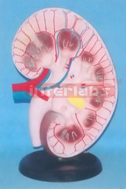 SUPER KIDNEY ANATOMICAL ENLARGED MODEL